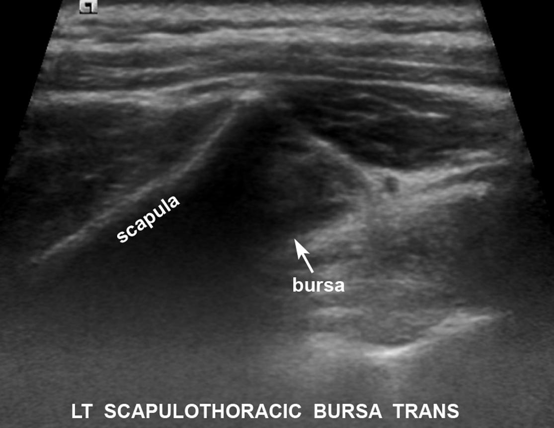 Courtesy John Read, MD